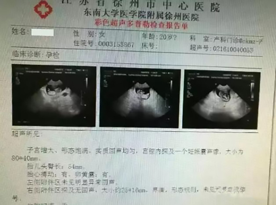 Pic shows: The girls pregnancy test; A man who took his pregnant wife to hospital for a check-up was detained by police after the "woman" was found to be no older than 12. The girl, unnamed in reports, was accompanied the 40-year-old man and another woman who claimed to be her mother-in-law. The trio arrived at the Xuzhou City Central Hospital, in East Chinas Jiangsu Province, claiming that the girl was 12 weeks pregnant and that she needed a routine test to confirm that her foetus was healthy. The husband and mother-in-law said the wife was 20 years of age, but medics immediately alerted local authorities when they found the young patient to be more like a schoolgirl than a "woman". Doctors who tried to question the girl were unable to get any answers from her, as she did not speak any Mandarin. One of the staff said: "Its obvious she is just a child, not 20 years old." Their suspicion is also said to have angered the husband, who was quoted as saying: "I took her here to be examined - just do your job. Stop asking so many questions." Arriving police officers found that the girl did not possess a Chinese ID and concluded that she was a foreign national from Southeast Asia, but her exact origins are still unclear. Investigators suspect that she was abducted or bought as a foreign bride - the Chinese have a history of purchasing Vietnamese brides from across the countrys southern border. However, further investigation is now under way to determine the facts